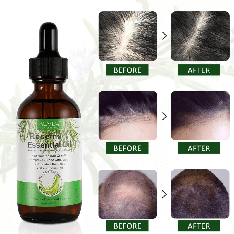 Glosair™ Premium Essential Hair Growth Oil