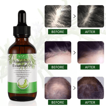 Glosair™ Premium Essential Hair Growth Oil