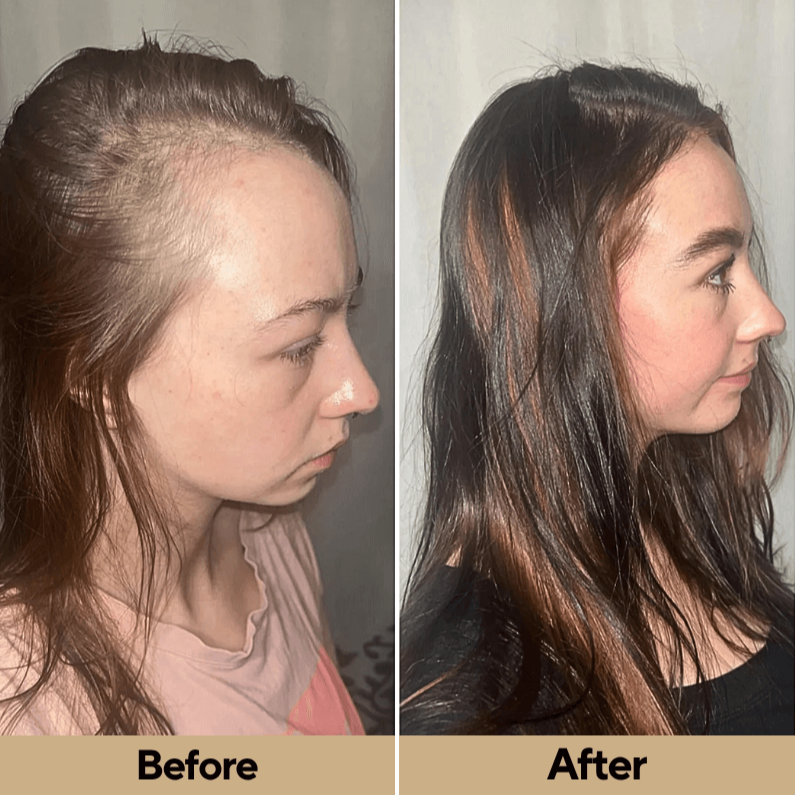 Glosair™ Premium Red Light Hair Therapy Brush